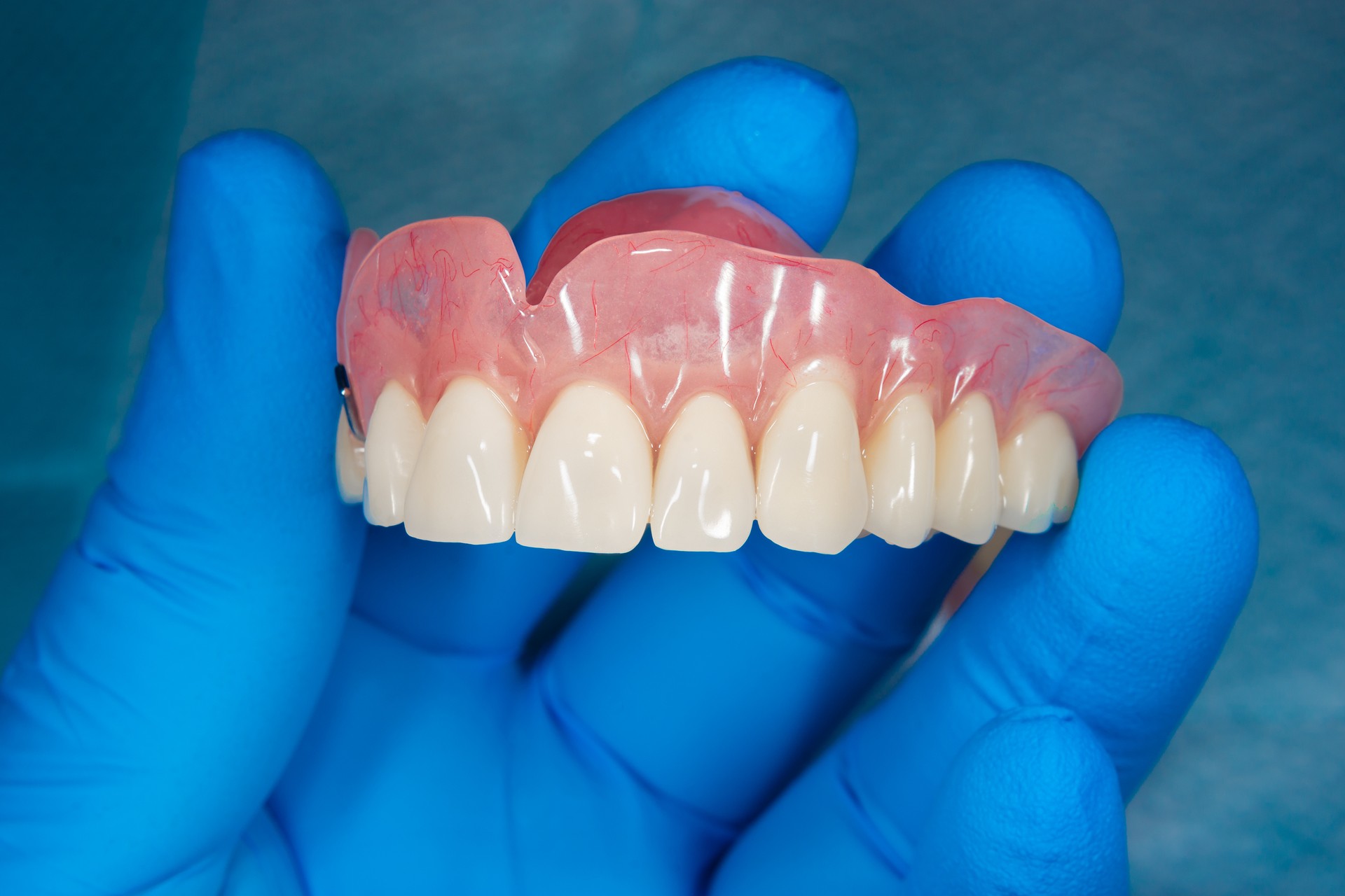 Close-up human denture of the upper jaw on a blue background in the hand of a dentist wearing a medical glove