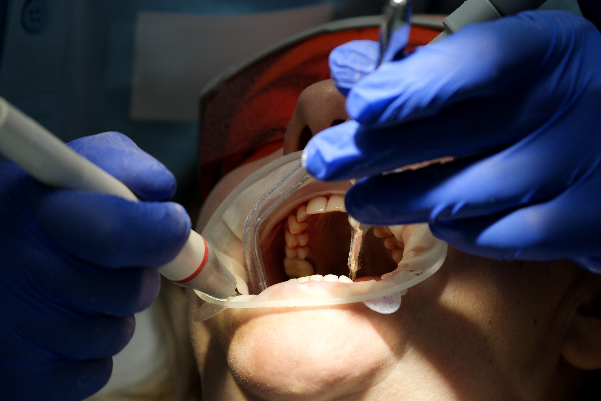 Doctor scans the patient's teeth in the clinic. The dentist holds in his hand a manual 3D scanner for the jaw and mouth. Dental health. Creates a 3D model of teeth and gums on a medical monitor.